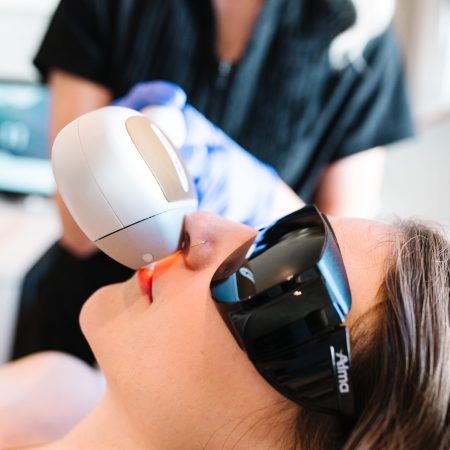 Upper lip hair removal for women