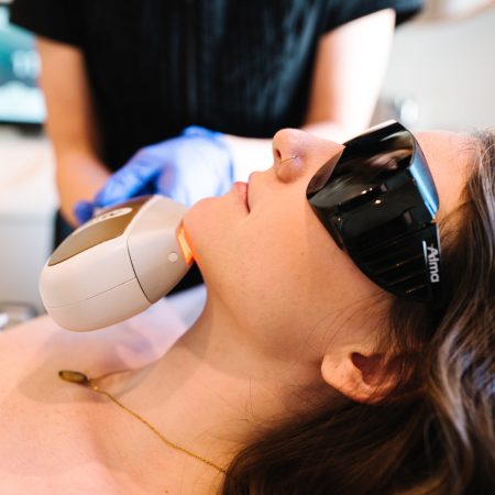Laser treatment on woman’s chin area