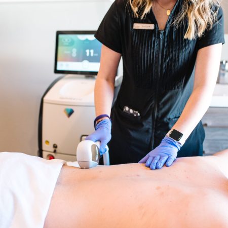 Laser hair removal on man’s back