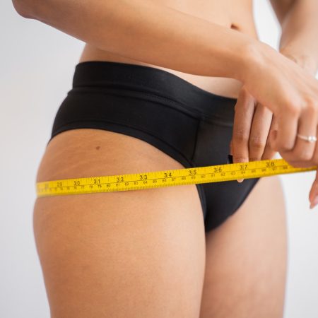 Woman measuring body fat before treatment