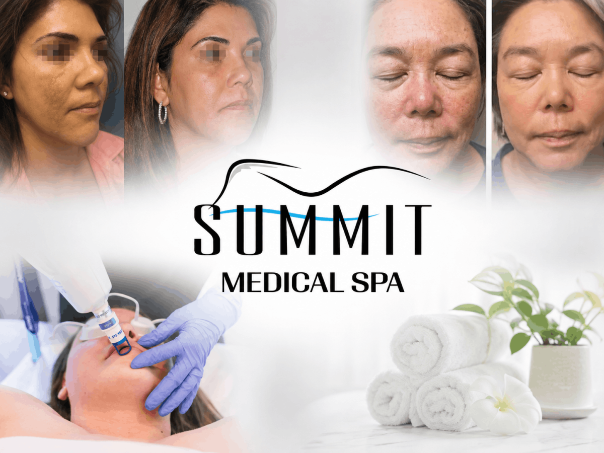 Summit Medical Spa ClearLift treatment with laser facial care and results