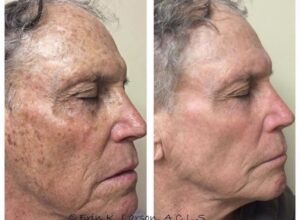 Rejuvenation treatments restore your skin